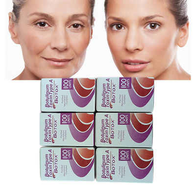 De Antirimpel  van de injectie 1-5ml 100 Anti de Rimpelinjecties van Eenhedenbtx