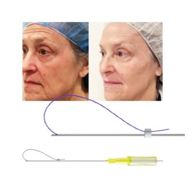 3D van de de Draadlift van 4D 6D PDO van de de Neusdraad van de de Injectiefacelift Mono de Tornadoschroef