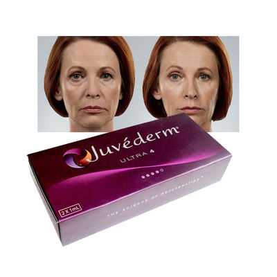 Ultra3 Juvederm hyaluronzuur huidvuller 20 mg / ml lipvergrotingsvullers