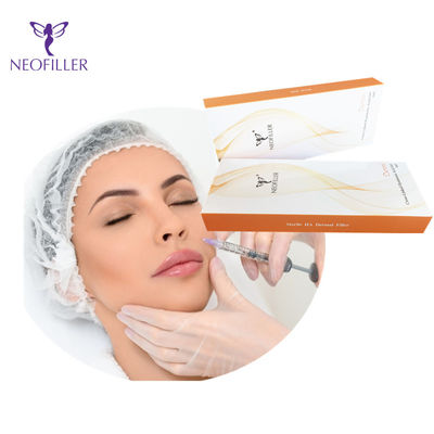 Kruis van Derm van de Neofiller Hyaluronic Zure HuiddieVuller voor Injecteerbare Lippen wordt verbonden