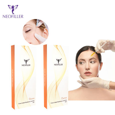 Kruis van Derm van de Neofiller Hyaluronic Zure HuiddieVuller voor Injecteerbare Lippen wordt verbonden