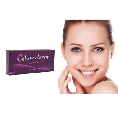 Juvederm injecteerbare gel voor gezichtskwaliteit van toonaangevende vullen rimpels en lijnen