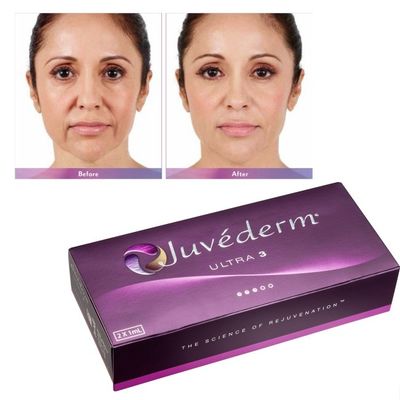Hyaluronzuur Juvederm Gezichtsfiller Gel gladde en vlekkeloze huid