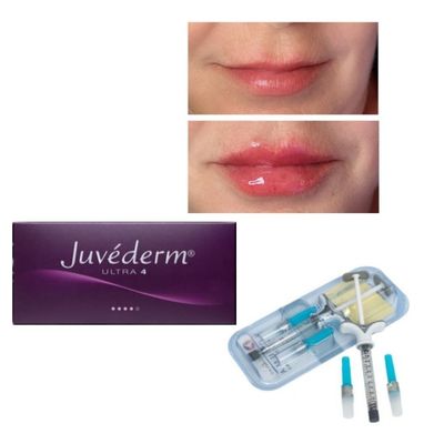 6-9 maanden Duur Juvederm Dermal Filler Gel online en in de winkel