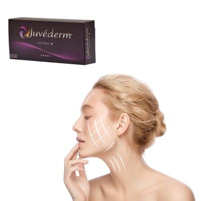 Hyaluronzuur huid vulgel voor het vullen van rimpels - Juvederm Solution