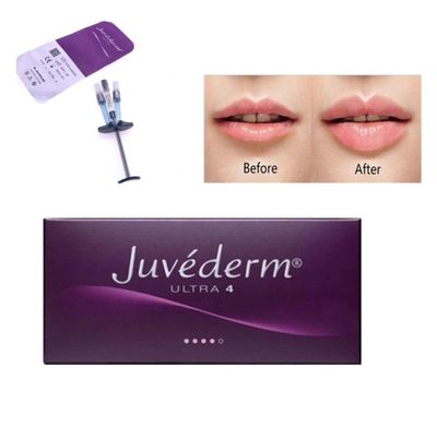 2 ml gezichtsverzorging Juvederm Cross Linked Dermal Filler Hyaluronzuur Injectie