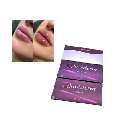 De gezichtslip Crosslinked het Huid Hyaluronic Zure Gel van Vullerjuvederm Ultra3