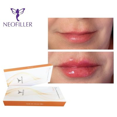 1ml Hyaluronzuur Gezichts Dermal Filler Voor 9-12 Maanden Natuurlijke Verjonging