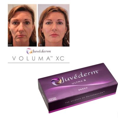 Juvederm Dermal Filler injecteerbare gel met hyaluronzuur voor 6-9 maanden Duur en opslag bij kamertemperatuur
