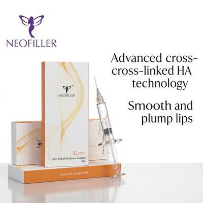 1 ml hyaluronzuur huidvuller injecteerbare gel met een looptijd van 8 tot 15 maanden en biocompatibel cross-linked hyaluronzuur