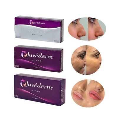 juvederm Langdurig injecteerbaar huidvuller 2 jaar houdbaarheid
