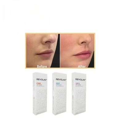 Fijne Deep Sub-Q Revolax Dermal Filler met Gladde en Elastische Gelconsistentie voor Natuurlijk Uitziende Gezichtsvolume Herstel
