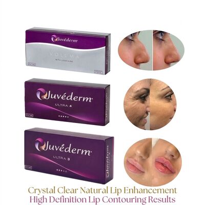 Volume van de spuit 2 1 ml per doos Juvederm Voluma Filler Veiligheid Gezichtscontouren Injecteerbare huidfiller voor volumevergroting