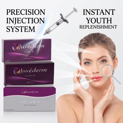 Juvederm Ultra 4 Neusvulling Hyaluronzuur Dermale vulmiddel voor niet-chirurgische neusvervorming