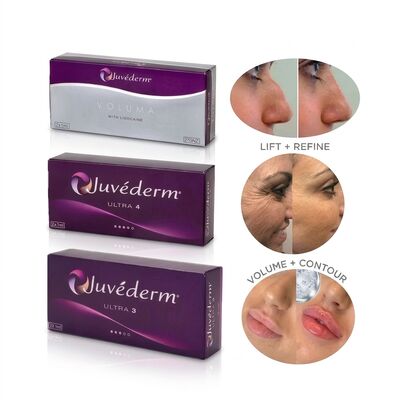 Juvederm Ultra 4 Neusvulling Hyaluronzuur Dermale vulmiddel voor niet-chirurgische neusvervorming