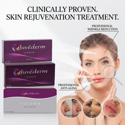 Juvederm Ultra 3 Nasolabiaalplooi Filler Hyaluronzuur Huidvuller om Lachrimpels Glad te Strijken 24mg/ml