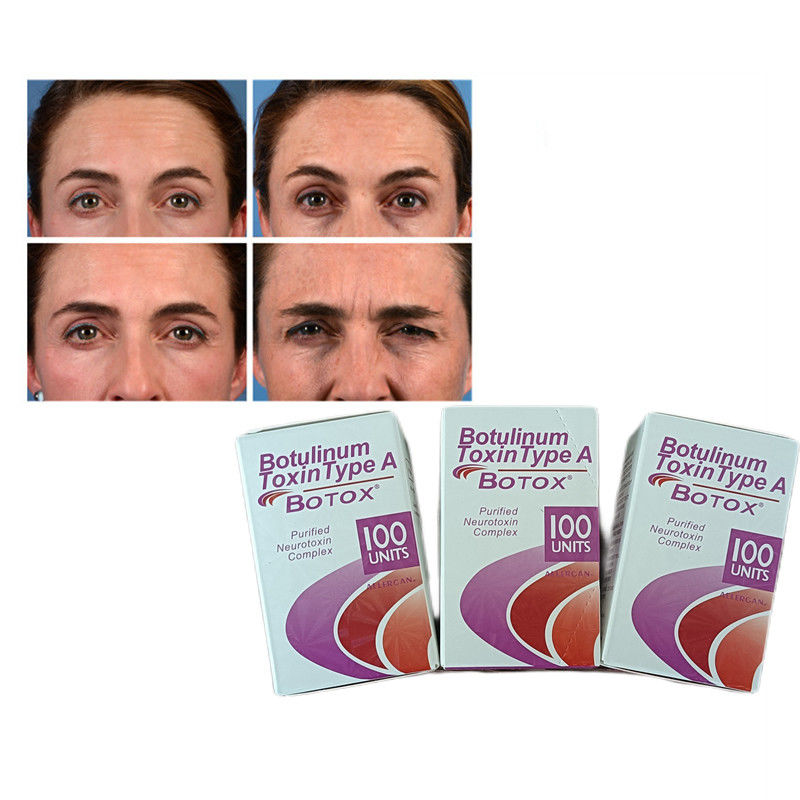 100 U/flacon Botulinum Toxin Type A Anti Wrinkle  poeder