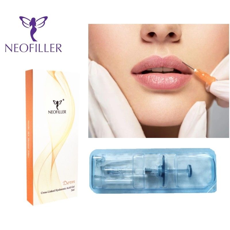 1ml Hyaluronzuur Gezichts Dermal Filler Voor 9-12 Maanden Natuurlijke Verjonging