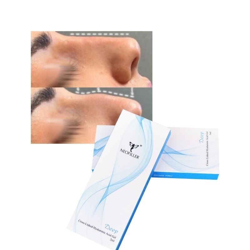 Cross-linked 2 ml hyaluronzuur Dermale Filler Deep Line Neuscontour Injecteerbare gel Gezichtsvergroting