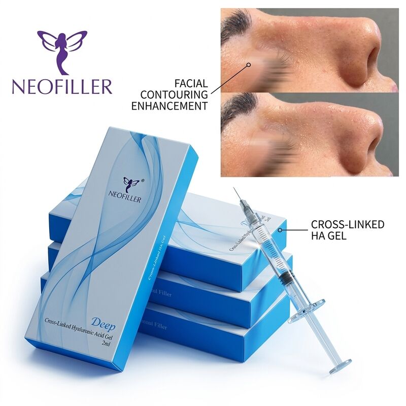 Diepe lijn Anti-rimpel Hyaluronzuur Dermal Filler Injecteerbare gel Lipverbetering Gezichtsvolumeherstel